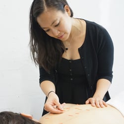 Emily Siy, Licensed Acupuncturist