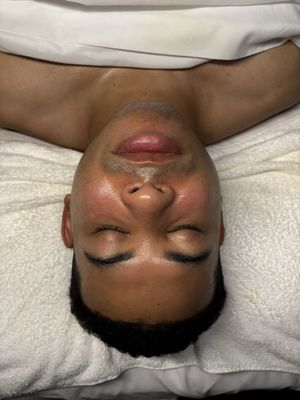 Basic facial - Facial cleansing removes dirt, makeup, pollution, and buildup from the skin while helping prevent clogged pores and acne. Basic facial - Facial cleansing removes dirt, makeup, pollution, and buildup from the skin while helping prevent clogged pores and acne.