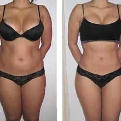 Secret Beauty Esthetic Spa - Body Contouring