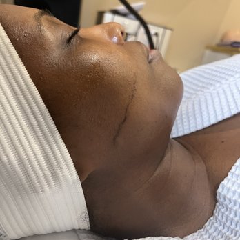 Visagè Esthetique - Dermaplaning Facial - Eyelash Service Near Me Visagè Esthetique - Dermaplaning Facial - Eyelash Service Near Me