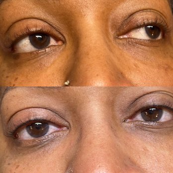 Saving Face - lash line enhancement tattoo...adds a fine line along the lid to give a little definition and makes lashes look thicker on the eyelid - Permanent Makeup Near Me - Gainesville, Virginia Saving Face - lash line enhancement tattoo...adds a fine line along the lid to give a little definition and makes lashes look thicker on the eyelid - Permanent Makeup Near Me - Gainesville, Virginia