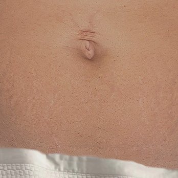 VitaTats - After - Hair Loss Centers Near Me VitaTats - After - Hair Loss Centers Near Me