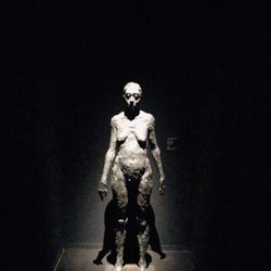 Museo della Follia