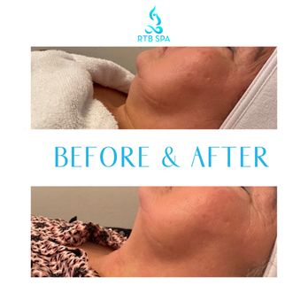 RTB Spa - Instasculpting - Massage Therapy Near Me - Houston, Texas RTB Spa - Instasculpting - Massage Therapy Near Me - Houston, Texas