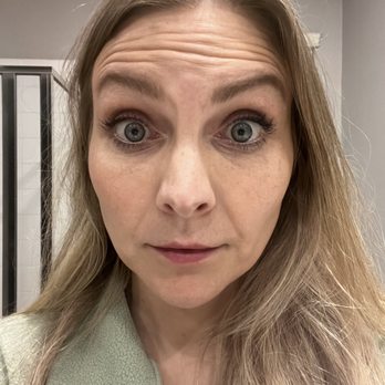 The Aesthetic Journey - Pre Botox - Medical Spas Near Me - San Clemente, California The Aesthetic Journey - Pre Botox - Medical Spas Near Me - San Clemente, California