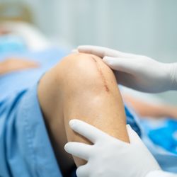 Complementary Therapies