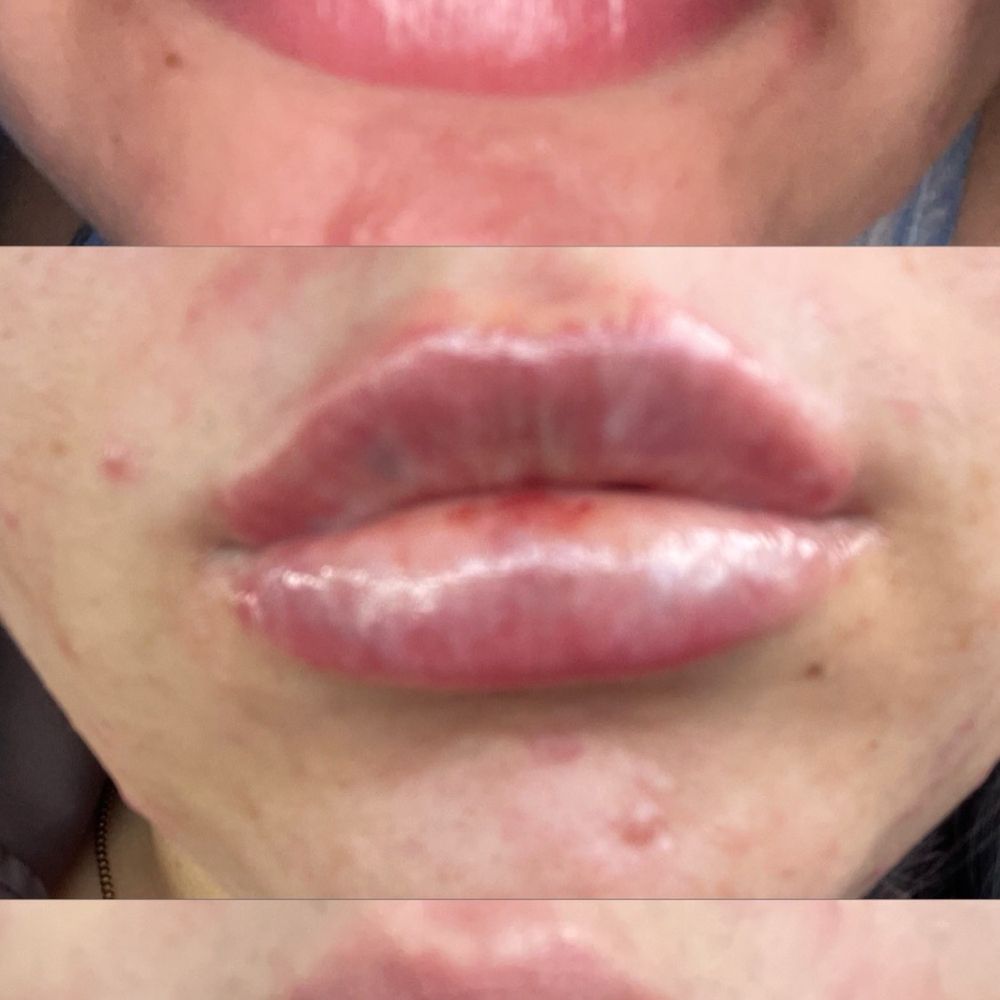 Bottom: before Middle: right after  Top: 12 days after