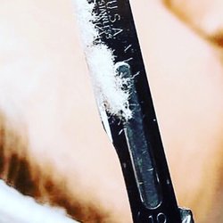 Black Velvet Spa Loft - Dermaplaning