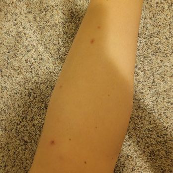 Comfort Suites - Scabies - Hotels Near Me - Corvallis, Oregon