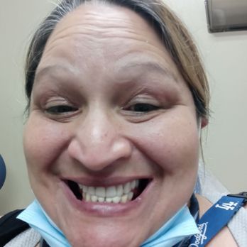 Djaya Tantra, DDS - My after picture - General Dentistry Near Me - Whittier, California