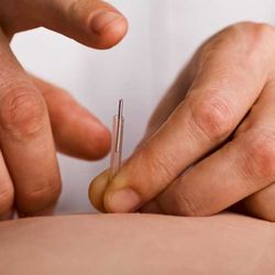 ACA Acupuncture & Wellness - Washington Heights - acupuncture