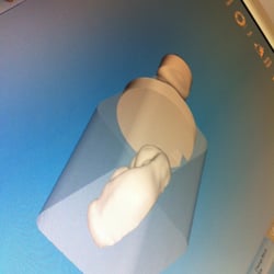 Sweetwater Dental Wellness - Cerec CAD technology: this is my new crown being designed.