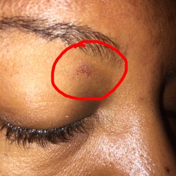 European Wax Center - The lady that did my eyebrows burned me. After I paid and left I noticed the burn. I WOULD NOT RECOMMEND THIS PLACE! It's small but painful! - Waxing Near Me - Elmhurst, Illinois European Wax Center - The lady that did my eyebrows burned me. After I paid and left I noticed the burn. I WOULD NOT RECOMMEND THIS PLACE! It's small but painful! - Waxing Near Me - Elmhurst, Illinois