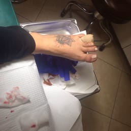 My friend got a toe infection cause the little lady cut her nail to short. Then made it worse trying to play doctor. My friend got a toe infection cause the little lady cut her nail to short. Then made it worse trying to play doctor.