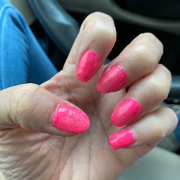 Cut my cuticle and now look at it.