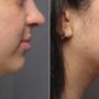 Photo of SoCal Aesthetic Surgery