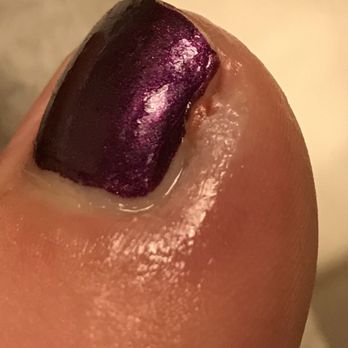 Kathy's Nail - Photo from urgent care, I got a pedi last Friday! - Nail Salons Near Me - Rocklin, California Kathy's Nail - Photo from urgent care, I got a pedi last Friday! - Nail Salons Near Me - Rocklin, California