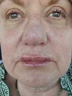 Texas Laser Institute