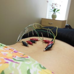 Wilson Stephen, MD - Medical Acupuncture with electrodes