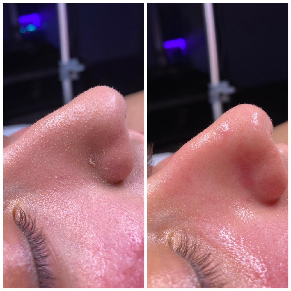 ALLURE SKIN CARE Updated September 2024 12 Photos 12 Lincoln Blvd, Emerson, New Jersey