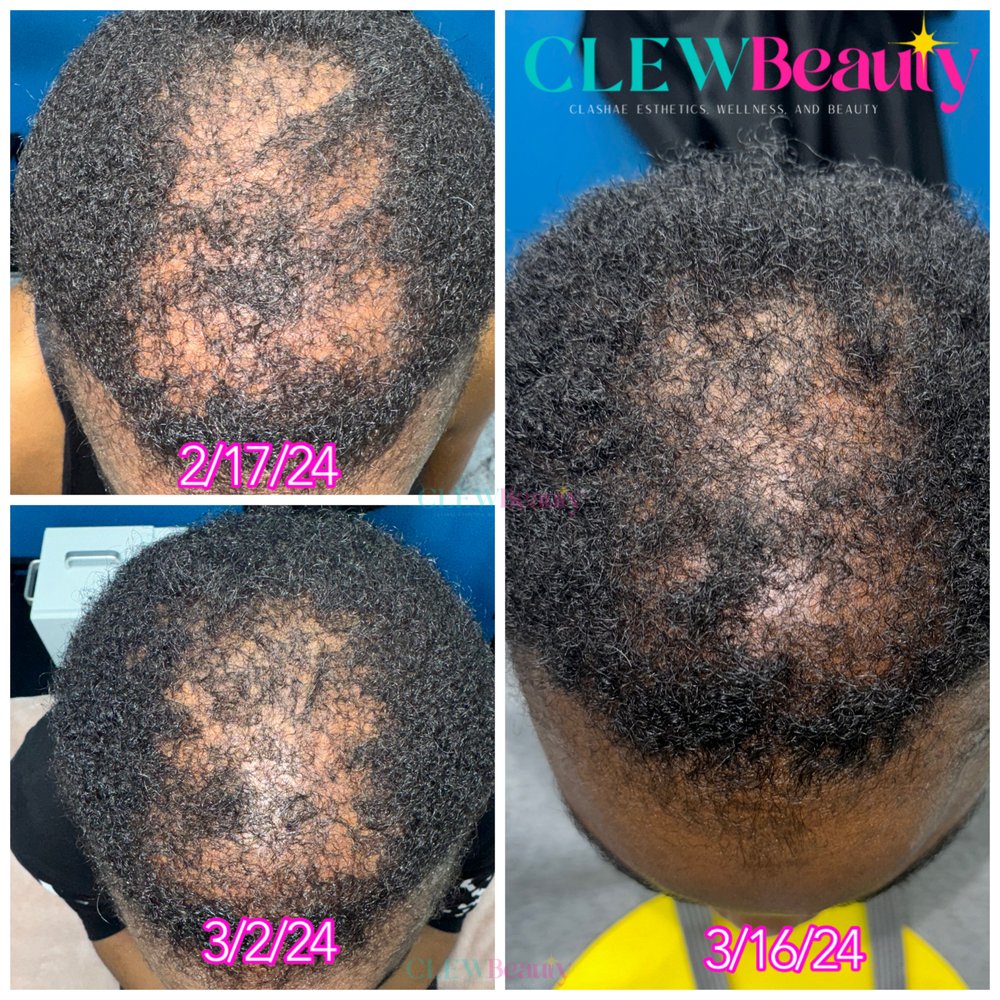 Clashae Esthetics Wellness and Beauty Logo