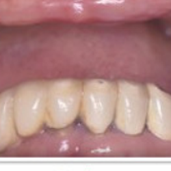 Raminder Singh, DDS - Elite Dental & Denture