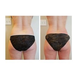 Virtue Holistic Skin Studio - 100% organic, instant results! Pure Beauty Body Sculpt