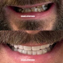 Daniel Jeffrey Cohen, DDS - Full Mouth Reconstruction