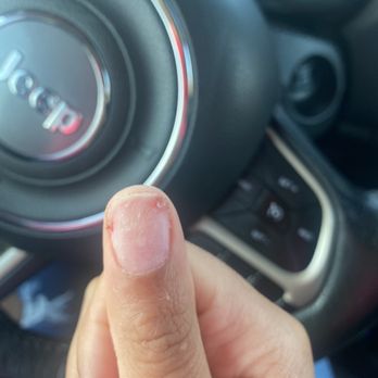Hollywood Nails and Spa - Right thumb right after I left. When he was using the fake nail to go under my SNS, it was going under a layer f my nail and it hurt. - Nail Salons Near Me - Greensboro, North Carolina