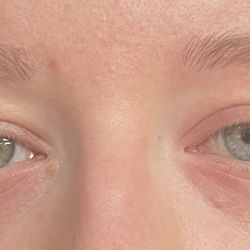 TPMG Coastal Allergy