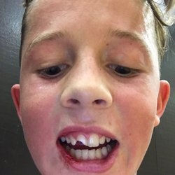 John G Barton, DDS