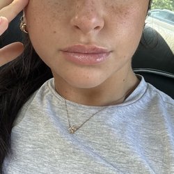 The Lip Loft - 0.5ML Lip Filler