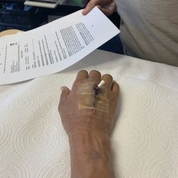 Banister Certified Hand Therapy - Post surgery