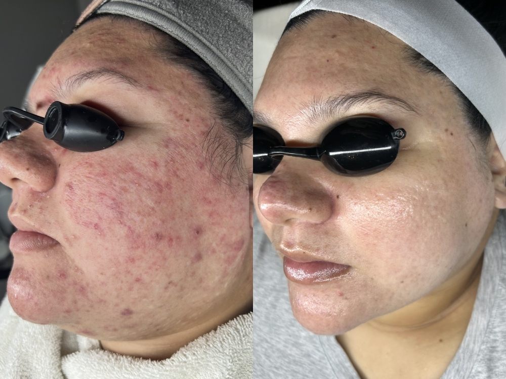 The Juvinex Room Logo