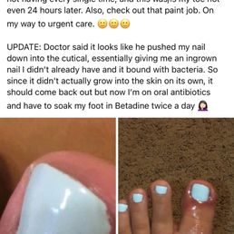 The infection Benny from TA Nails gave me The infection Benny from TA Nails gave me