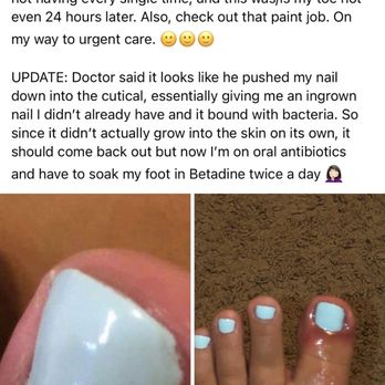 T A Nails - The infection Benny from TA Nails gave me - Nail Salons Near Me - Athens, Georgia T A Nails - The infection Benny from TA Nails gave me - Nail Salons Near Me - Athens, Georgia