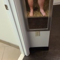 PeaceHealth Southwest Medical Center - THIS is what my leg looked like, and the Dr. prescribed baby aspirin.