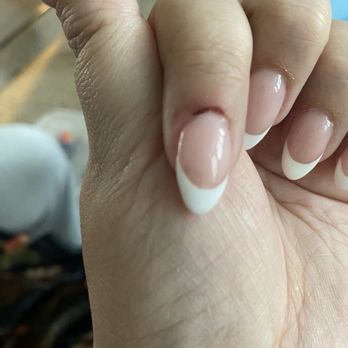 M Nail Lounge - Finger is now infected - Nail Salons Near Me - West Covina, California M Nail Lounge - Finger is now infected - Nail Salons Near Me - West Covina, California