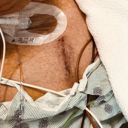 Peninsula Regional Health system - Cut used to replace heart  value AMAZING