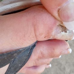Vinny Nails - I went to Vinny's nails to get my nails done and I got this fungus from color change If you want fungus on your toenails j