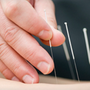 Photo of Manayunk Roxborough Community Acupuncture