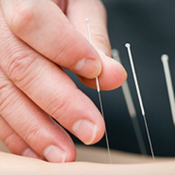 Manayunk Roxborough Community Acupuncture