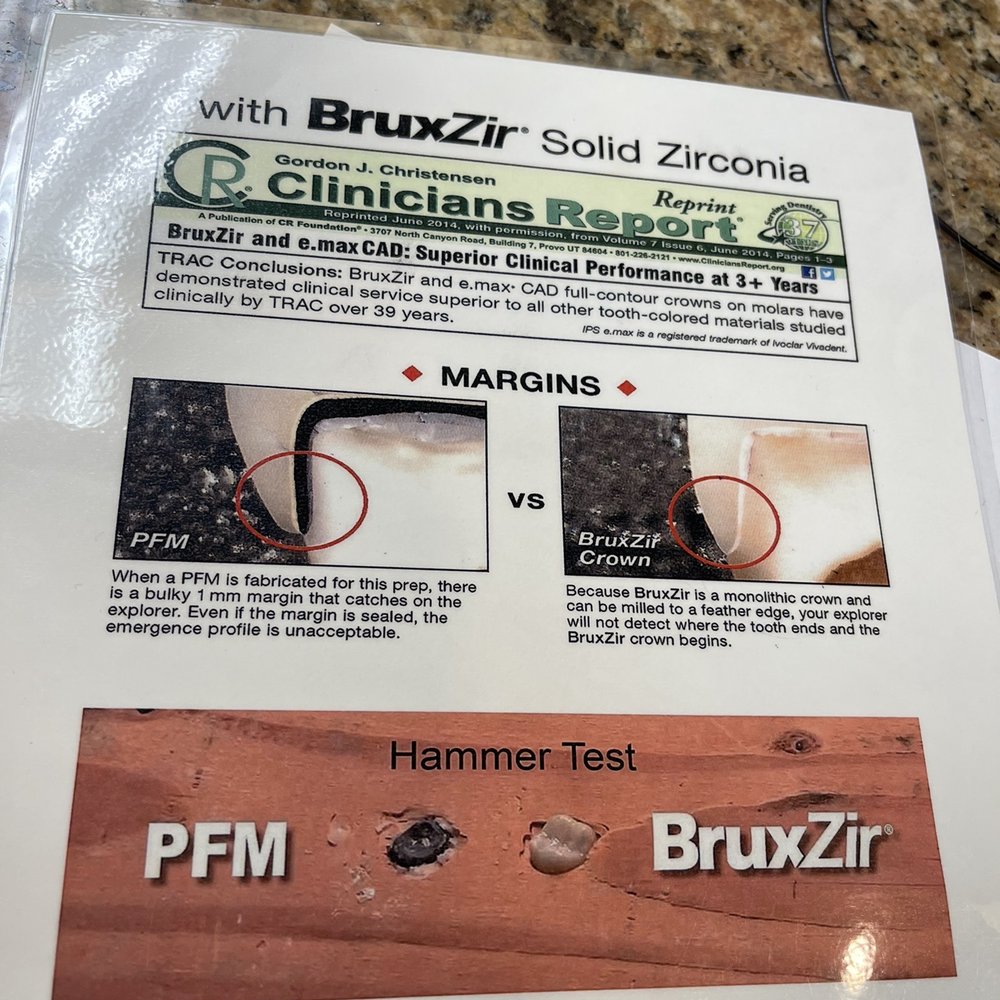 Signature Dental Group - PFM vs Bruxzir - General Dentistry Near Me - Upland, California Signature Dental Group - PFM vs Bruxzir - General Dentistry Near Me - Upland, California