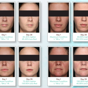 Body By Steph Tanning & Spa - Skin Brightening evens your skin tone, eliminates redness & Age Spots. It also lightens your pigment and exfoliates your entire body. - Skin Care Near Me - Henderson, Nevada Body By Steph Tanning & Spa - Skin Brightening evens your skin tone, eliminates redness & Age Spots. It also lightens your pigment and exfoliates your entire body. - Skin Care Near Me - Henderson, Nevada