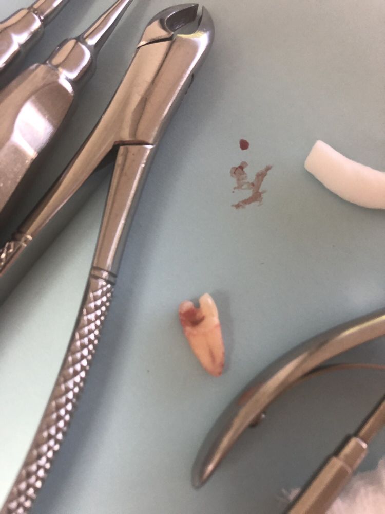 GLENDORA DENTAL 31 Photos & 33 Reviews 102 W Rte 66, Glendora, California Cosmetic