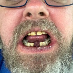 Thumbs Up Dental - Showing their work