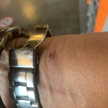 Monkey King At the Brewery - My right wrist - Cajun/Creole Near Me - Alameda, California Monkey King At the Brewery - My right wrist - Cajun/Creole Near Me - Alameda, California