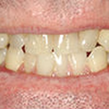 Berkeley Dentistry - Cosmetic Dentists Near Me - Berkeley, California