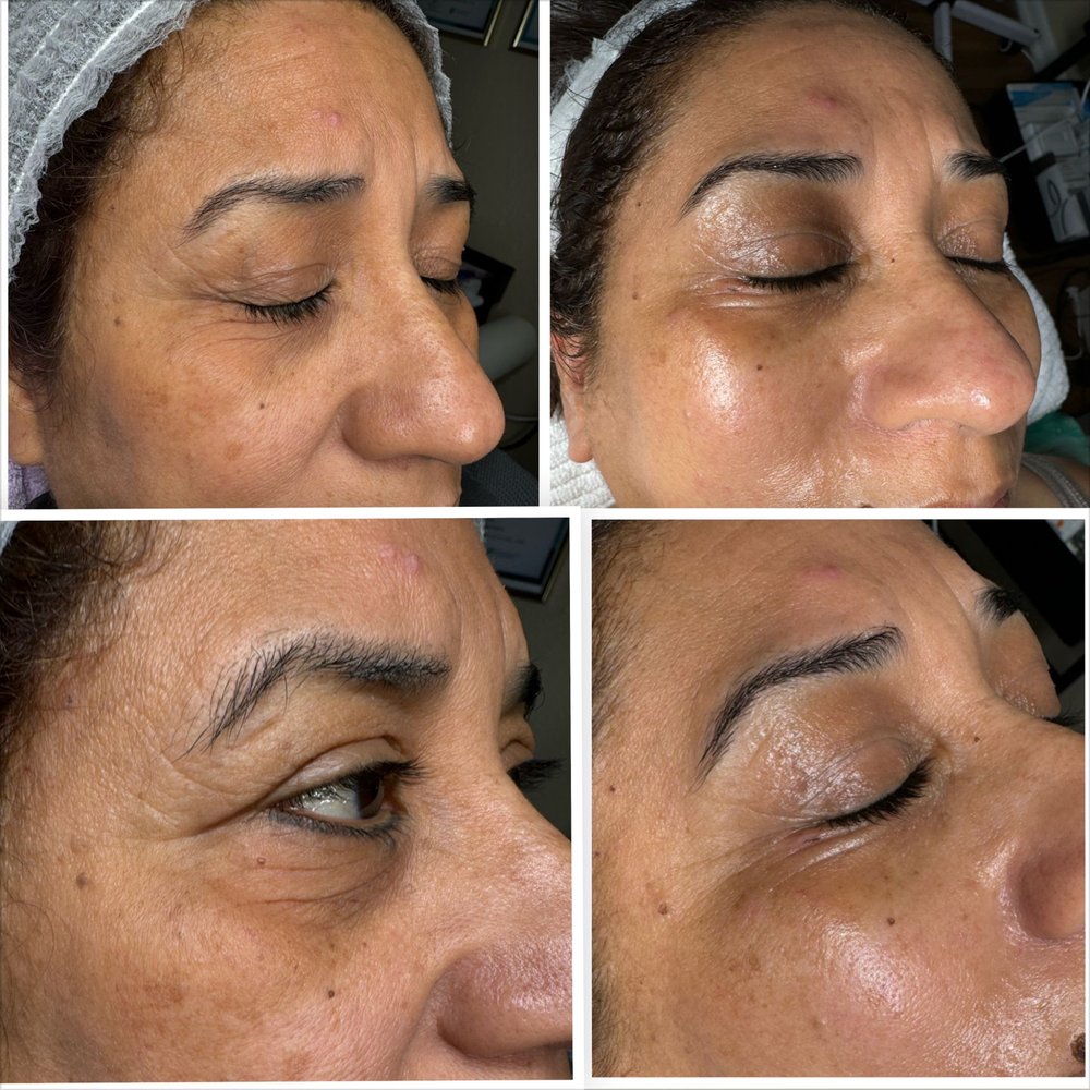 Nora Skin Care Spa Logo