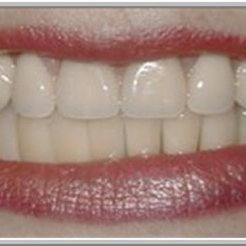 Lagrange Dental - Cosmetic Dentists Near Me - Lagrangeville, New York Lagrange Dental - Cosmetic Dentists Near Me - Lagrangeville, New York